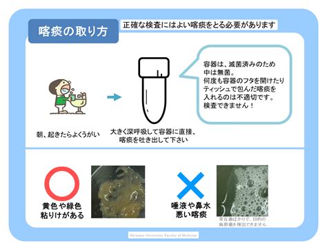 痰培養 採取方法 吸引 看護|喀痰検査（細菌検査）｜検体検査